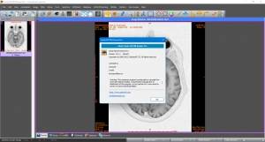 Sante DICOM Viewer Pro 14.2.0 [En]