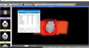 Sante DICOM Editor 10.2.0 [En]